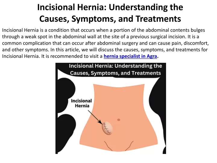 incisional hernia understanding the causes