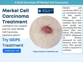 A Brief Overview Of Merkel Cell Carcinoma