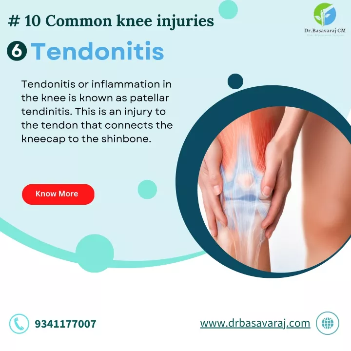 10 common knee injuries tendonitis