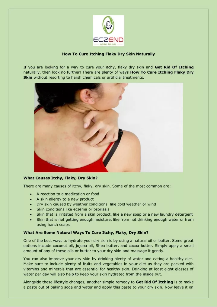 how to cure itching flaky dry skin naturally