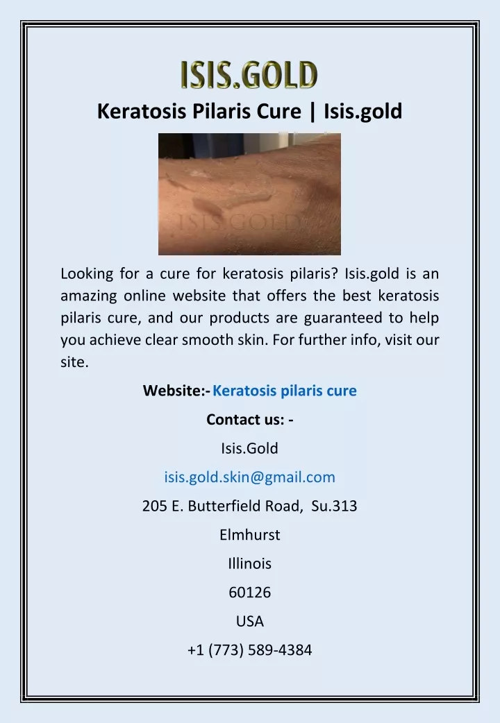 keratosis pilaris cure isis gold