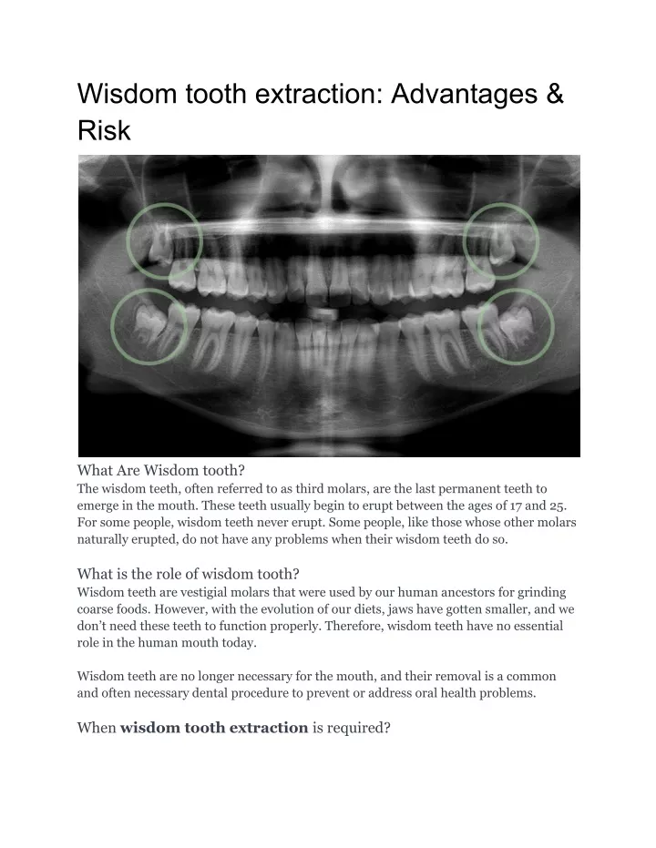 wisdom tooth extraction advantages risk