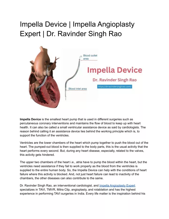 impella device impella angioplasty expert