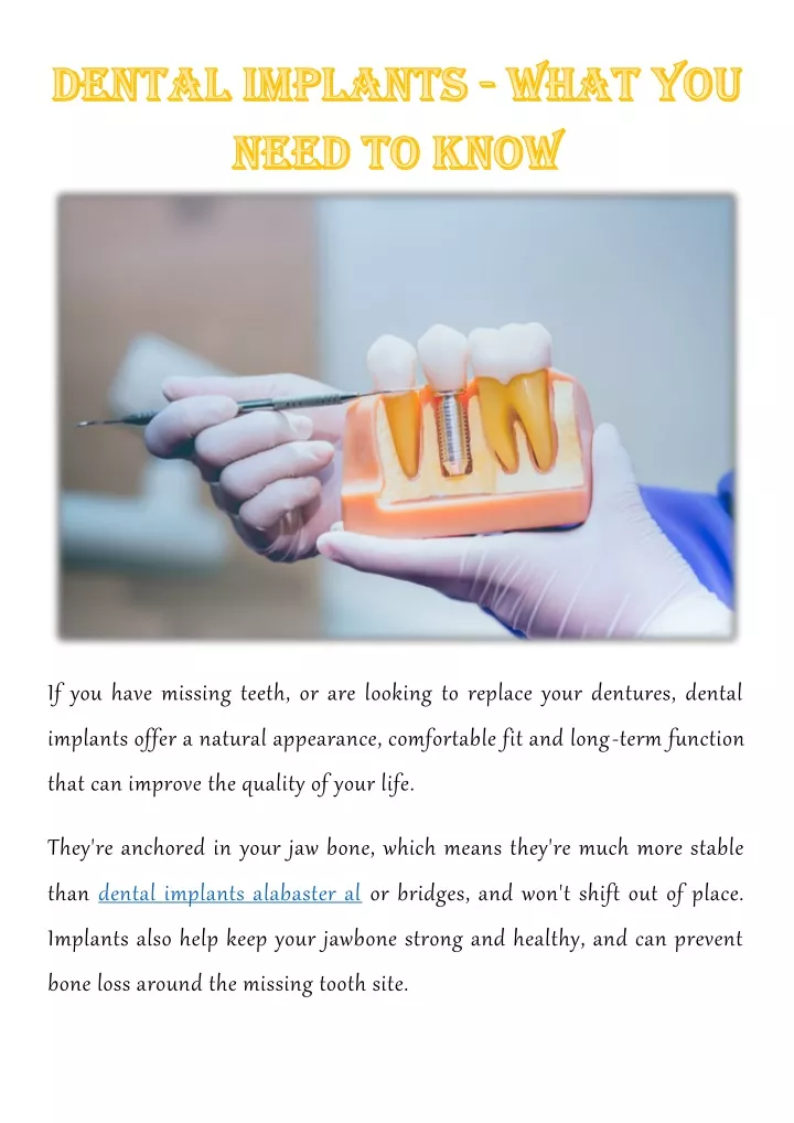 if you have missing teeth or are looking