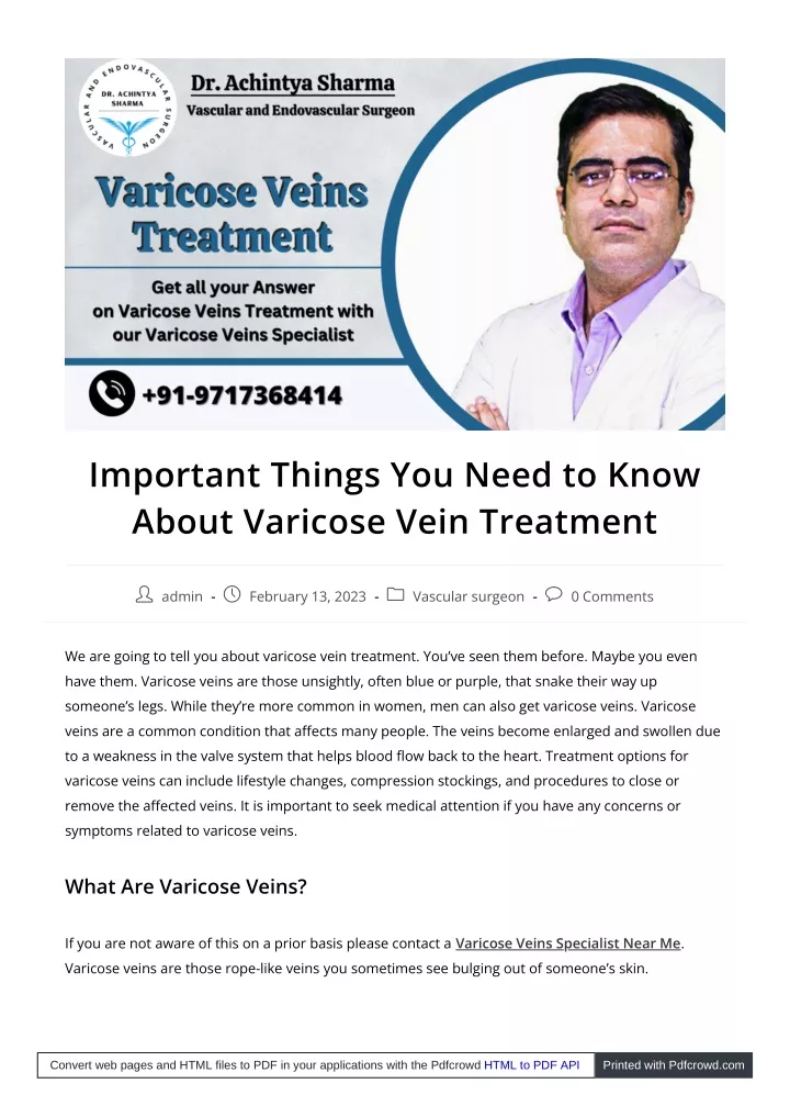 important things you need to know about varicose