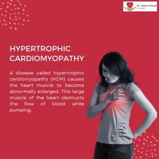 hypertrophic cardiomyopathy