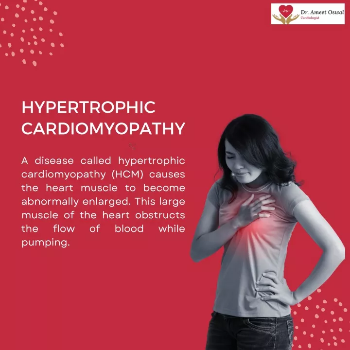 hypertrophic cardiomyopathy