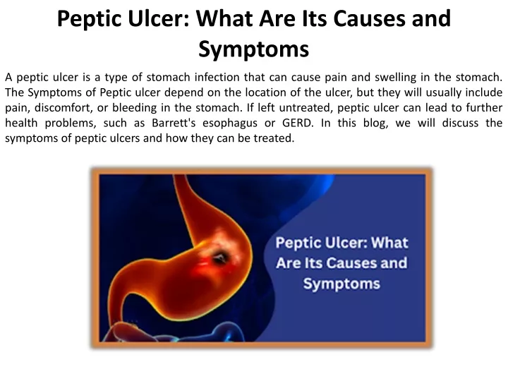 peptic ulcer what are its causes and symptoms