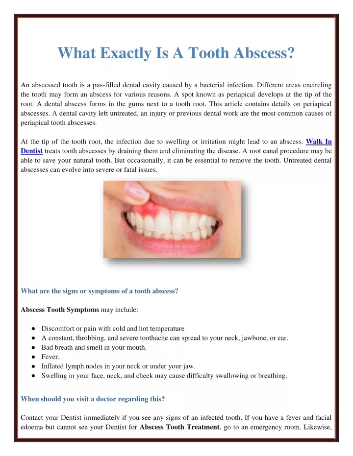 what exactly is a tooth abscess