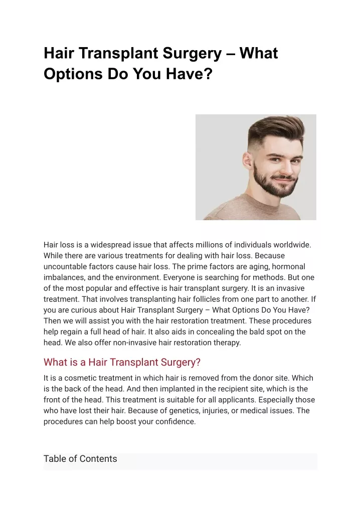hair transplant surgery what options do you have