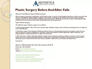 Plastic Surgery Before And After Fails