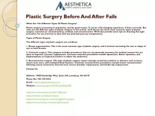plastic surgery before and after fails