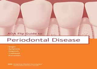 READ EBOOK [PDF] ADA Flip Guide to Periodontal Disease (ADA Flip Guides)