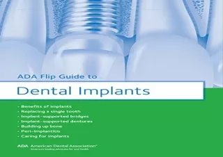 DOWNLOAD [PDF] ADA Flip Guide to Dental Implants (ADA Flip Guides)