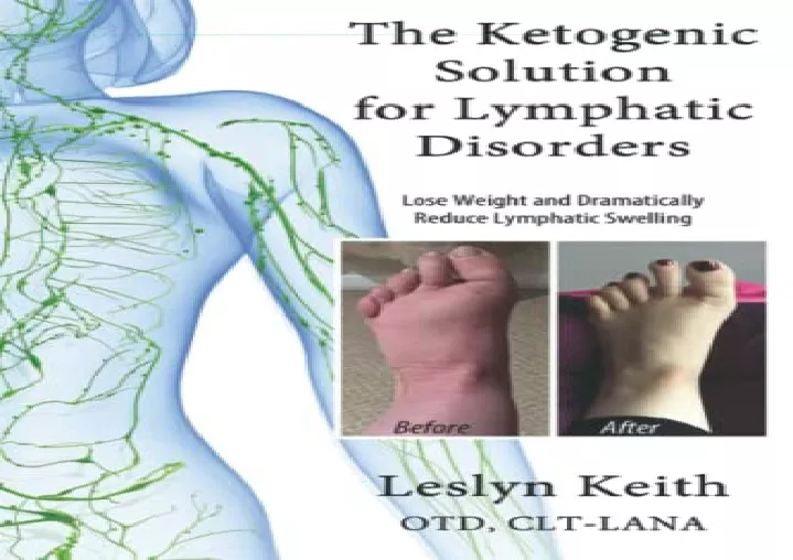 the ketogenic solution for lymphatic disorders