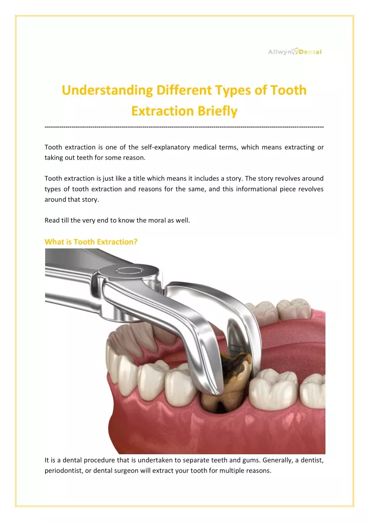 understanding different types of tooth extraction