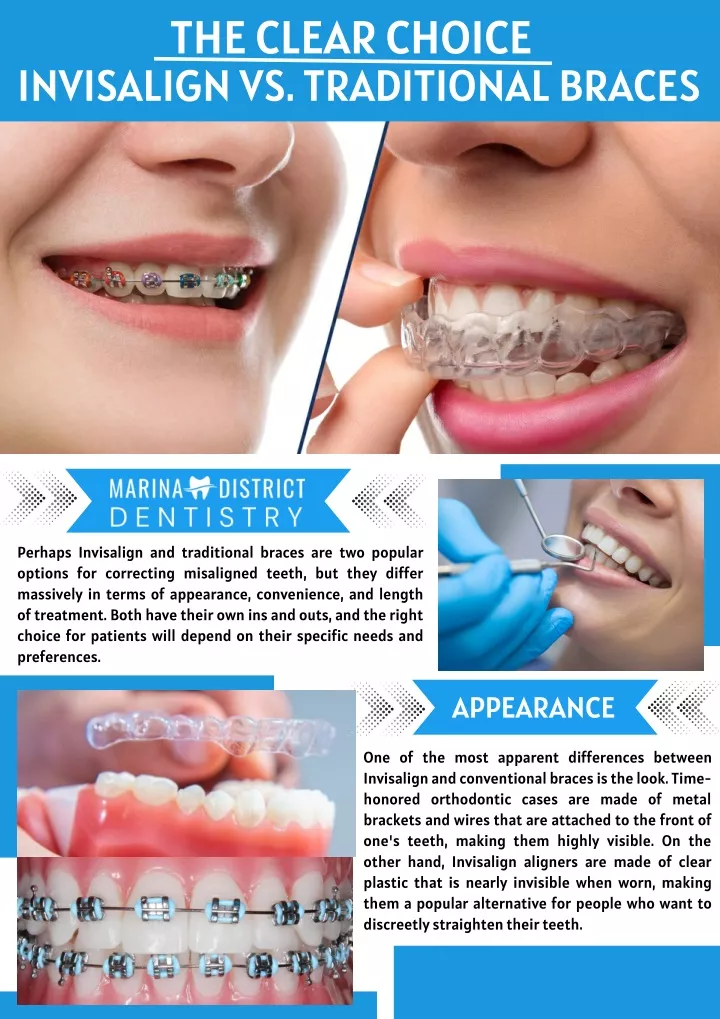 PPT - The Clear Choice Invisalign Vs. Traditional Braces PowerPoint ...