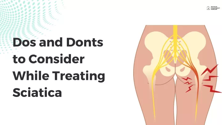 dos and donts to consider while treating sciatica