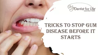 Tricks to Stop Gum Disease Before it Starts
