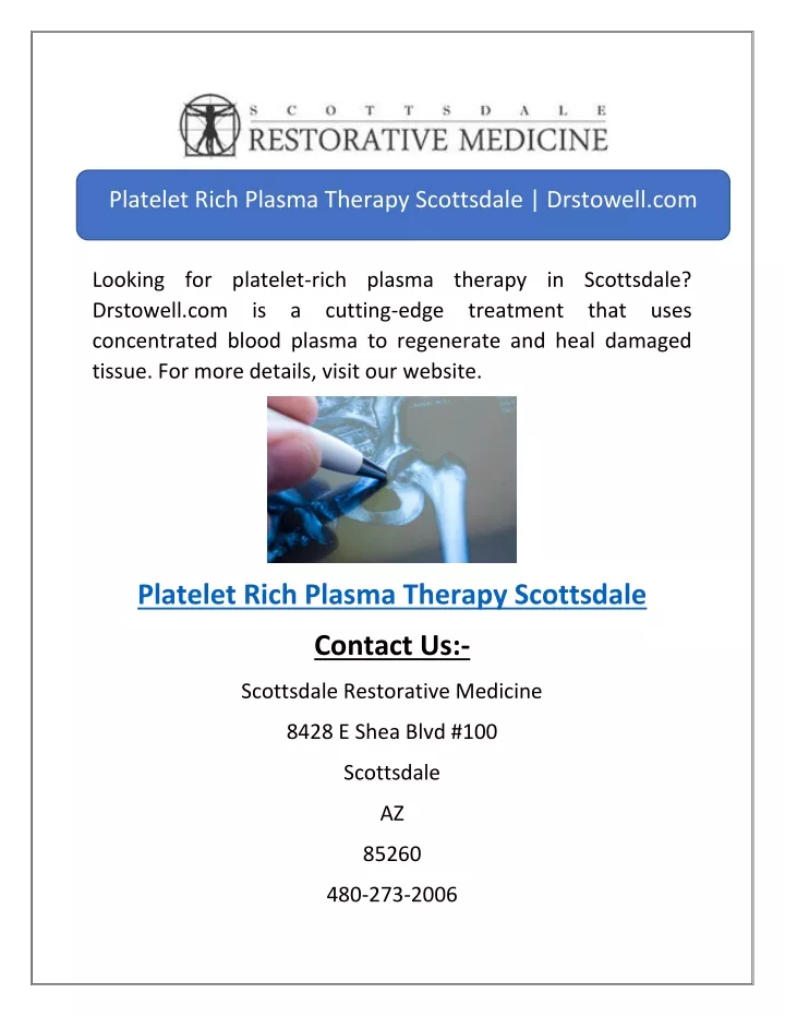 platelet rich plasma therapy scottsdale drstowell