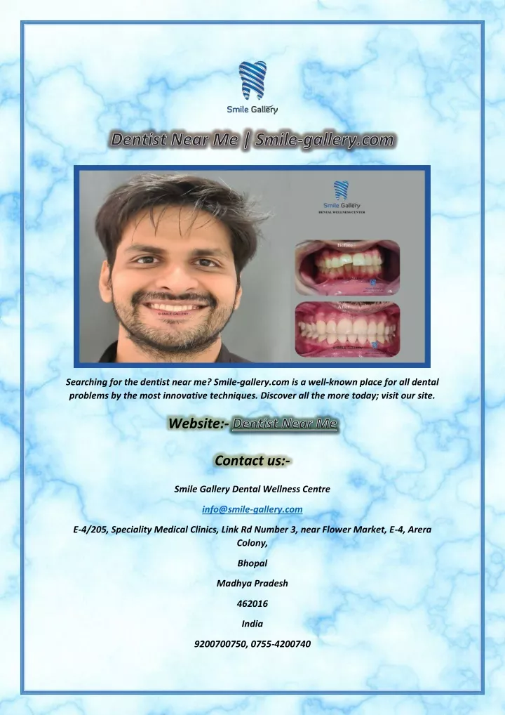searching for the dentist near me smile gallery