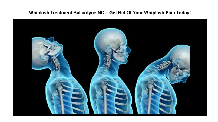 whiplash treatment ballantyne nc get rid of your