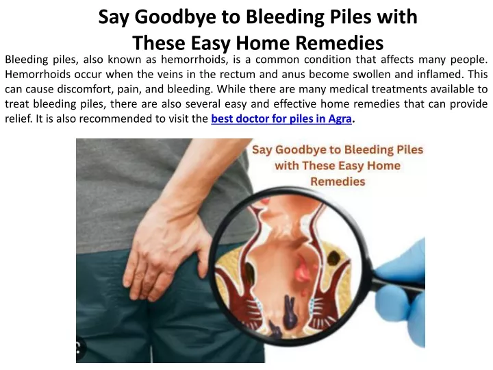 say goodbye to bleeding piles with these easy