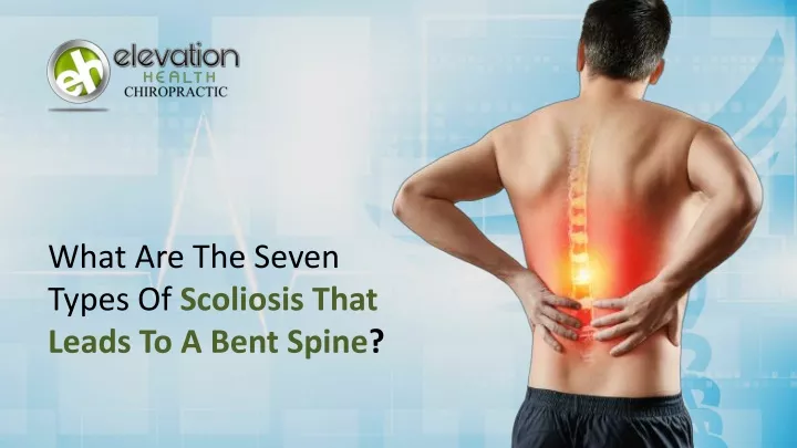 what are the seven types of scoliosis that leads