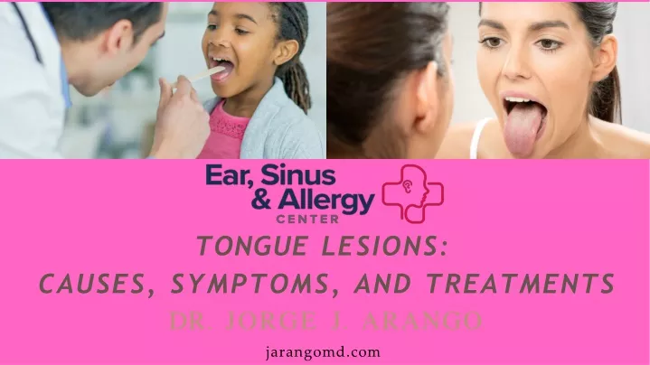 tongue lesions causes symptoms and treatments
