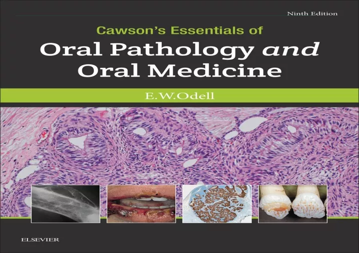 PPT - free read (pdf) Cawson's Essentials of Oral Pathology and Oral ...