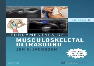 ‹download› [pdf] Fundamentals of Musculoskeletal Ultrasound E-Book (Fundamentals