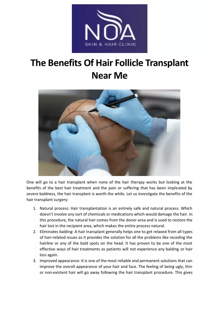 the benefits of hair follicle transplant near me