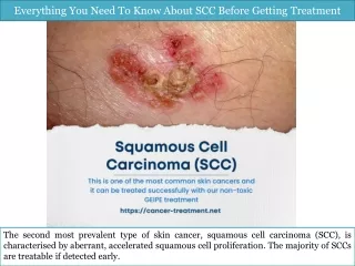 Everything You Need To Know About SCC Before Getting Treatment