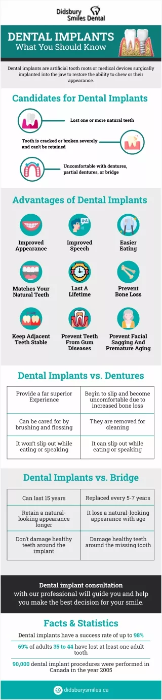Dental Implants What You Should Know