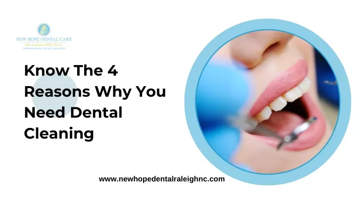 know the 4 reasons why you need dental cleaning