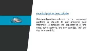 Chemical Peel for Acne Oakville  Skinbeautyandbeyond.com