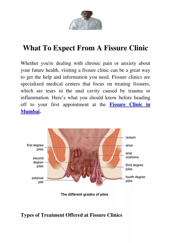 what to expect from a fissure clinic