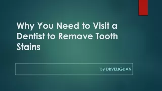 Why You Need to Visit a Dentist to Remove Tooth Stains