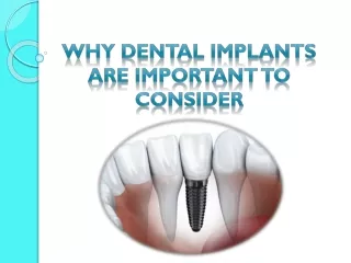 Why Dental Implants Are Important to Consider