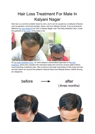 Hair Loss Treatment For Male In Kalyani Nagar