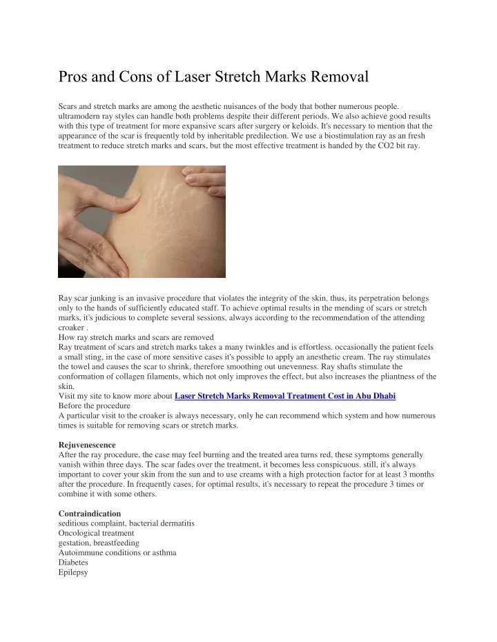 pros and cons of laser stretch marks removal