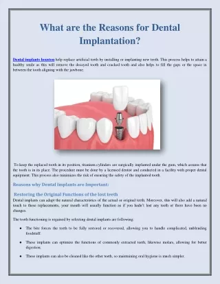 What are the Reasons for Dental Implantation?