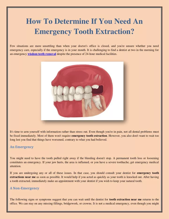 how to determine if you need an emergency tooth
