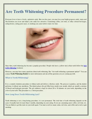 Are Teeth Whitening Procedure Permanent?