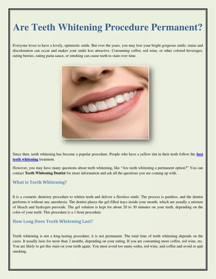 are teeth whitening procedure permanent