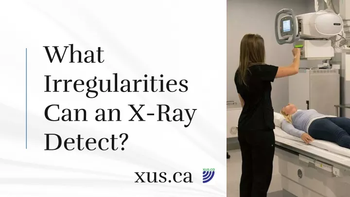 what irregularities can an x ray detect