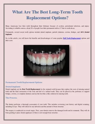 What Are The Best Long-Term Tooth Replacement Options?