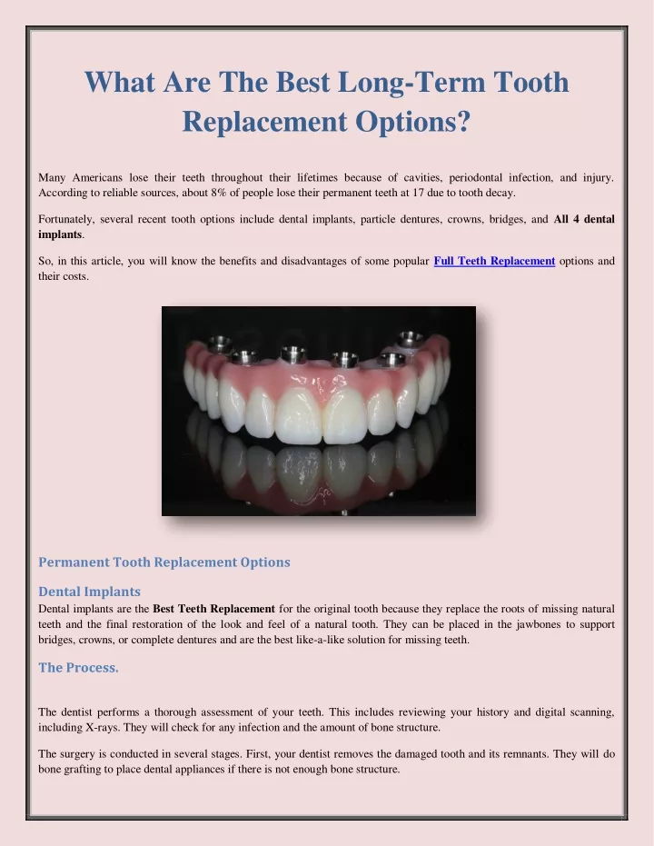 what are the best long term tooth replacement