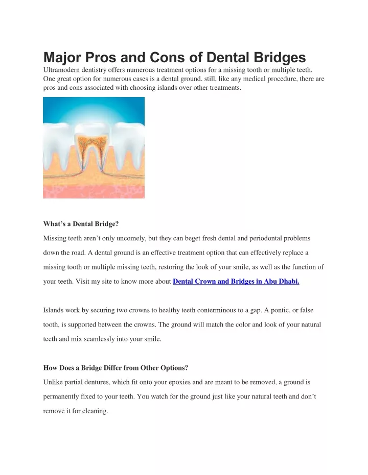 major pros and cons of dental bridges ultramodern