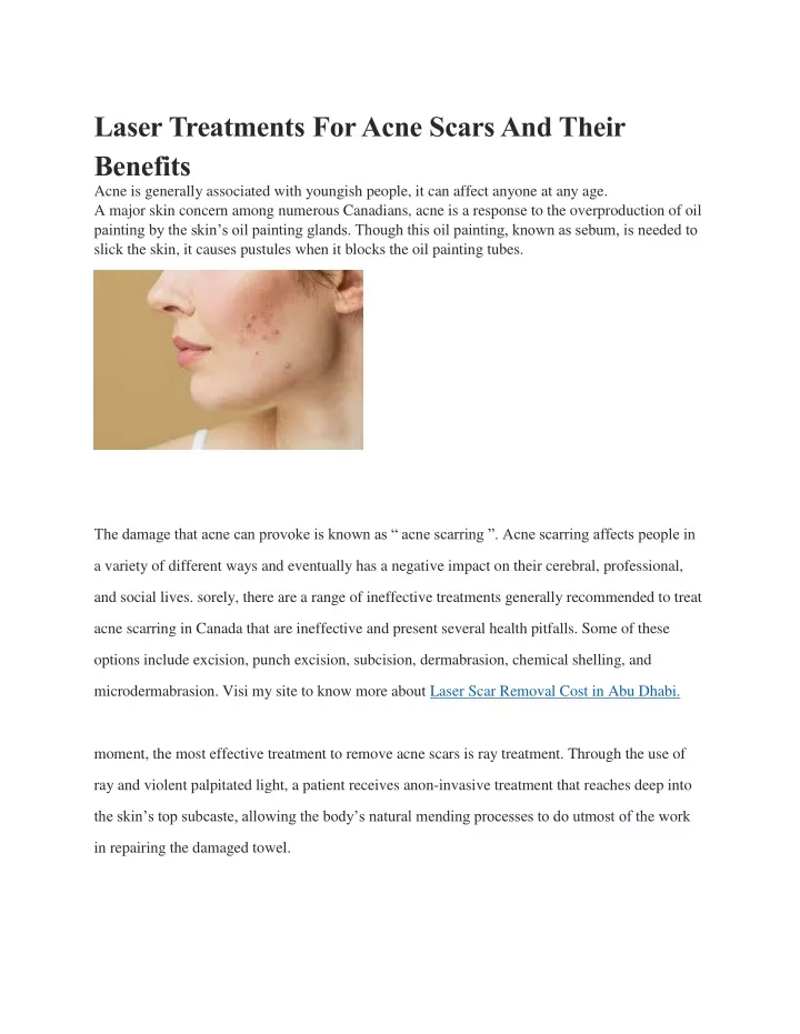 laser treatments for acne scars and their